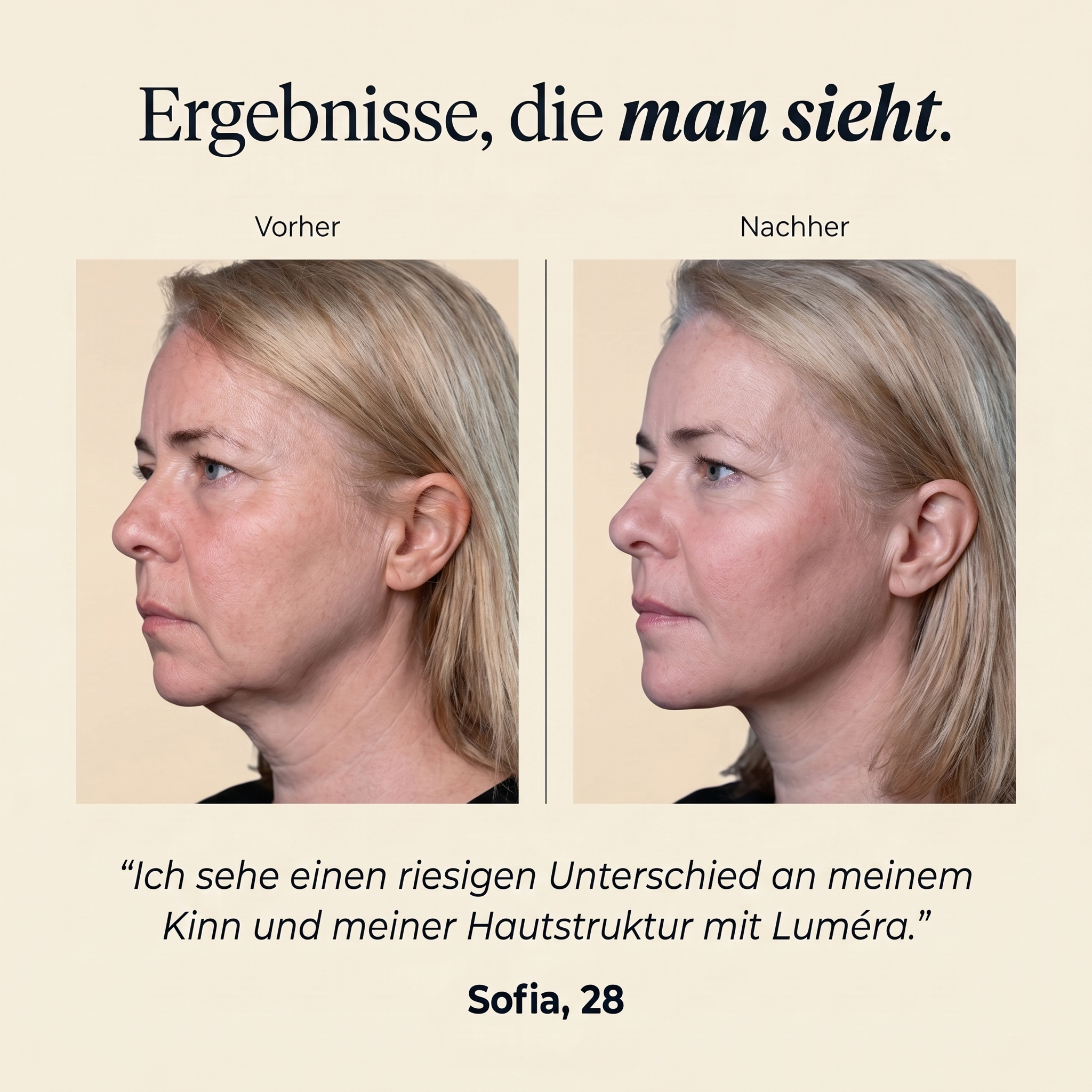 LUMÉRA™ JAW | Dual Infrarot Rotlichttherapie mit 3-Schicht Straff-Technologie™